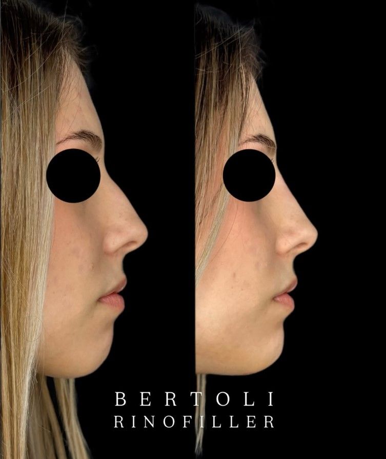 Andrea Bertoli-27