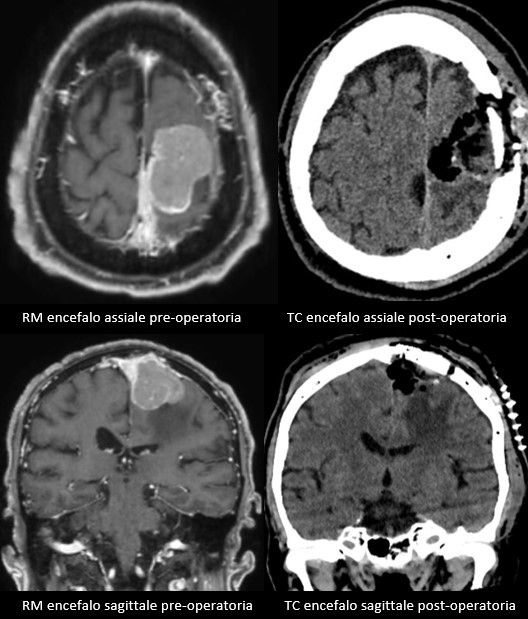 Alessandro Borderi-11