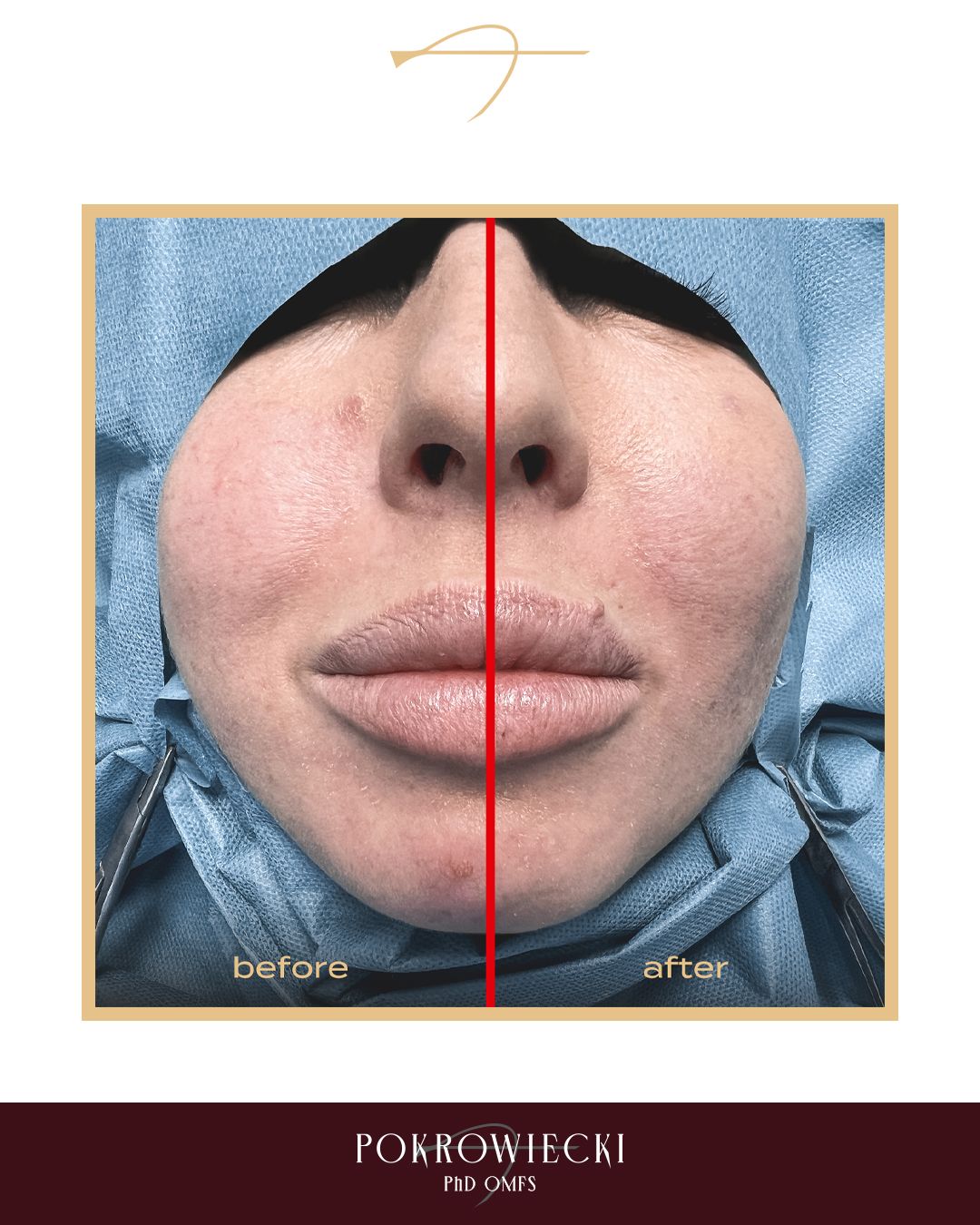 Rafał Pokrowiecki-21