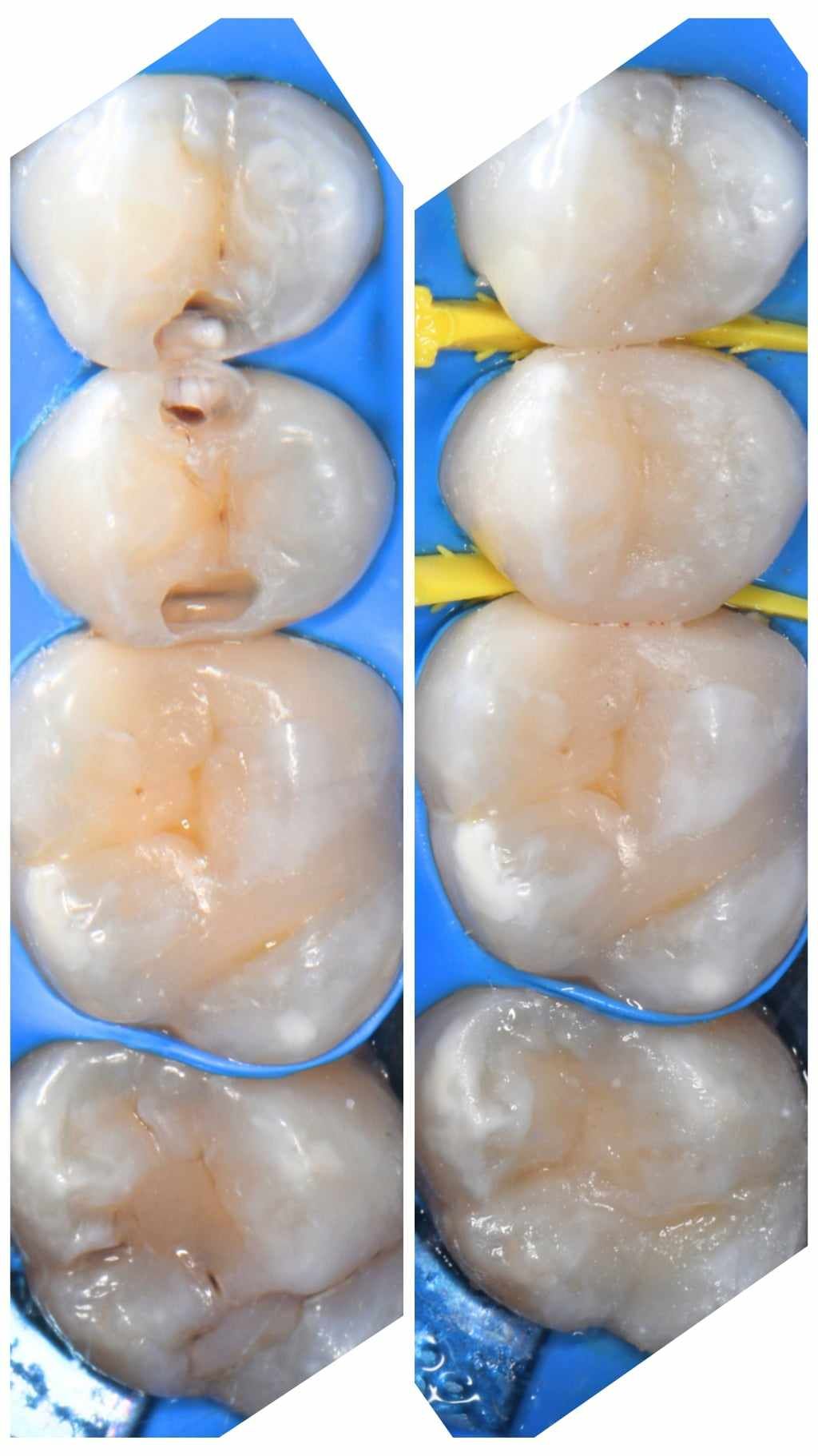 Damian Benbenkowski-0