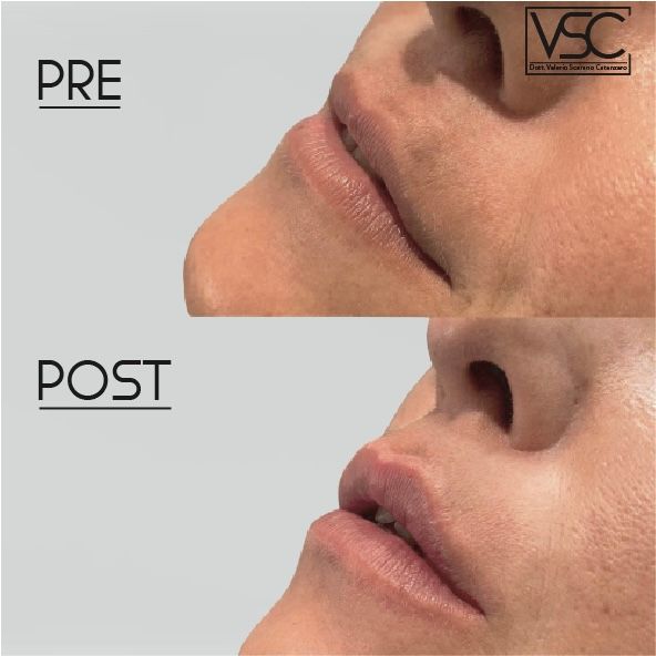 Valerio Scarano Catanzaro-14