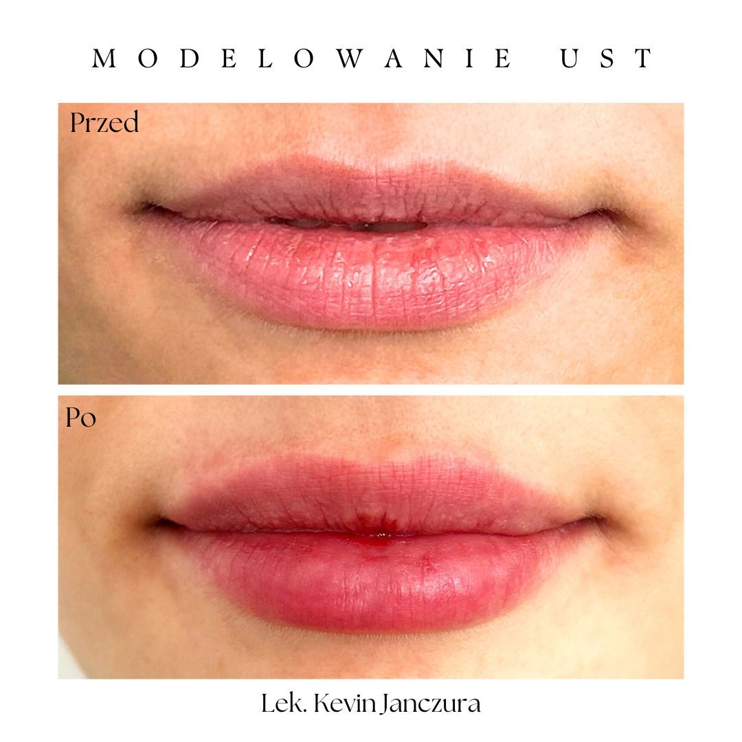 Kevin Poniatowski-3