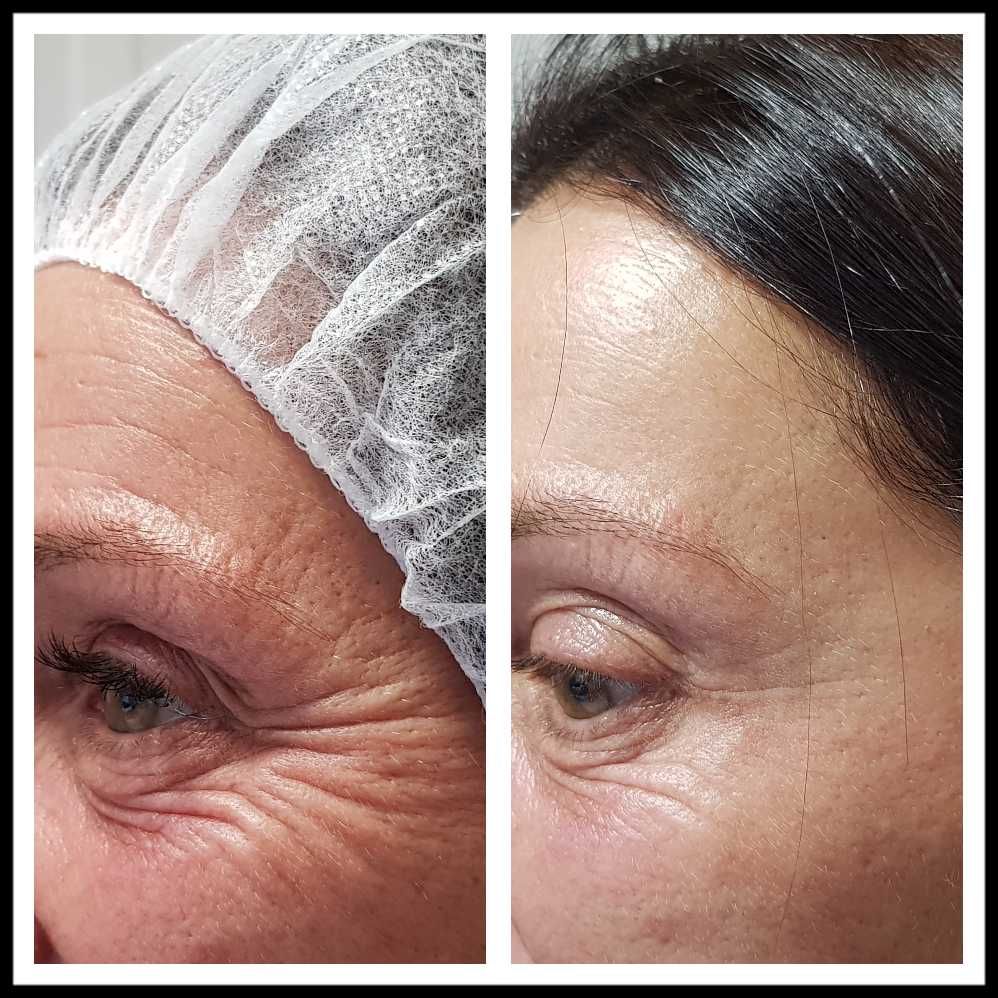 Rosalba Herrero Zerpa-371