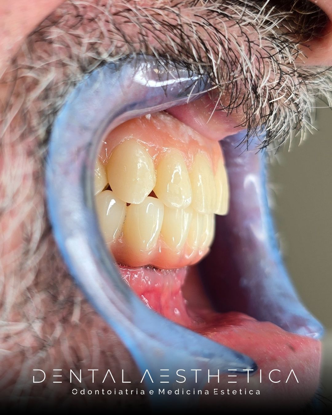 Claudio Marinelli-17