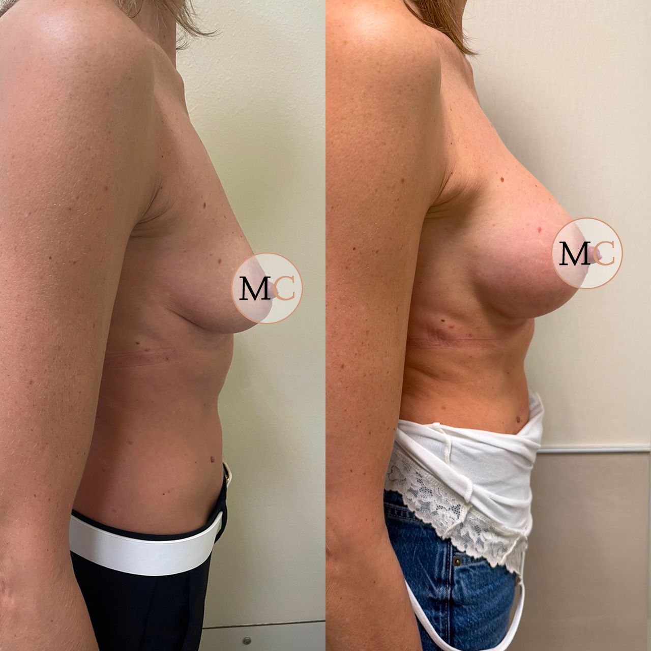 Marco Carmisciano-13