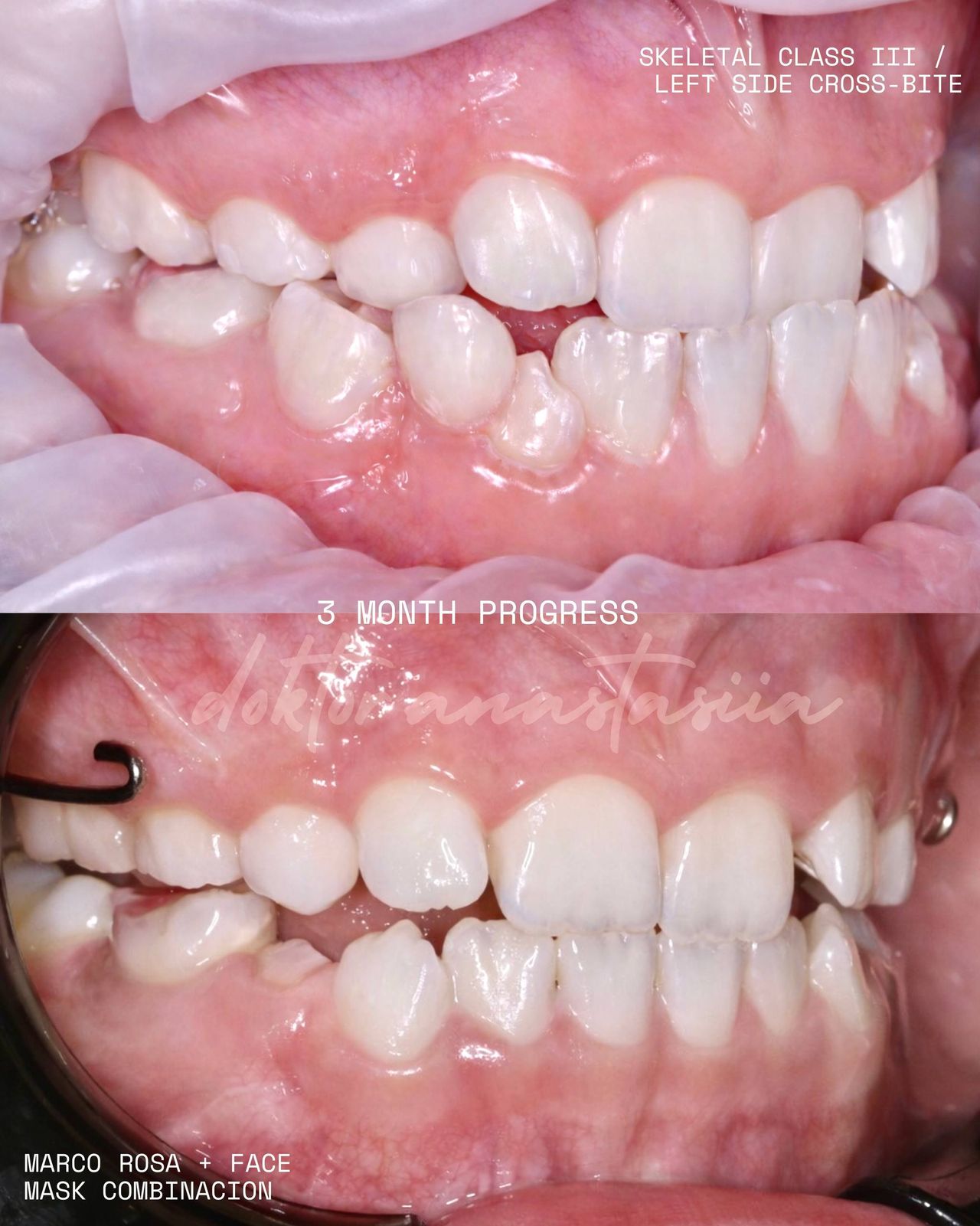 Anastasiia Malkina-0