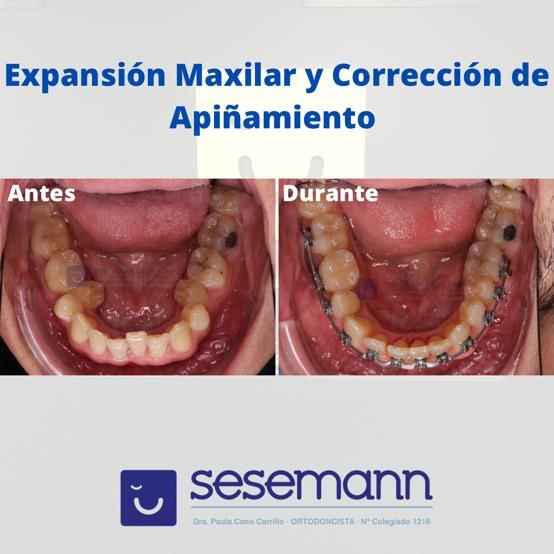 Paula Cano Carrillo-49