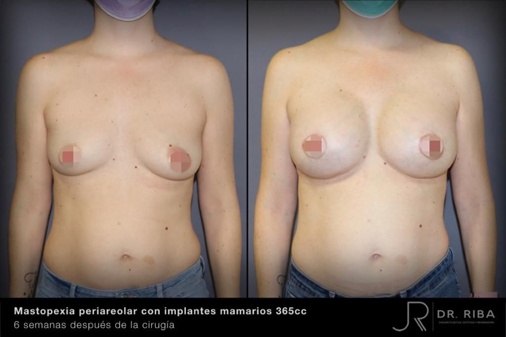 Jordi Riba Vilchez-46