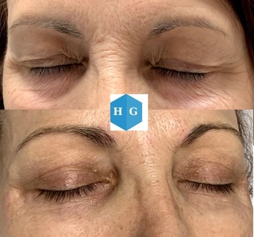 Humberto González Sánchez-16