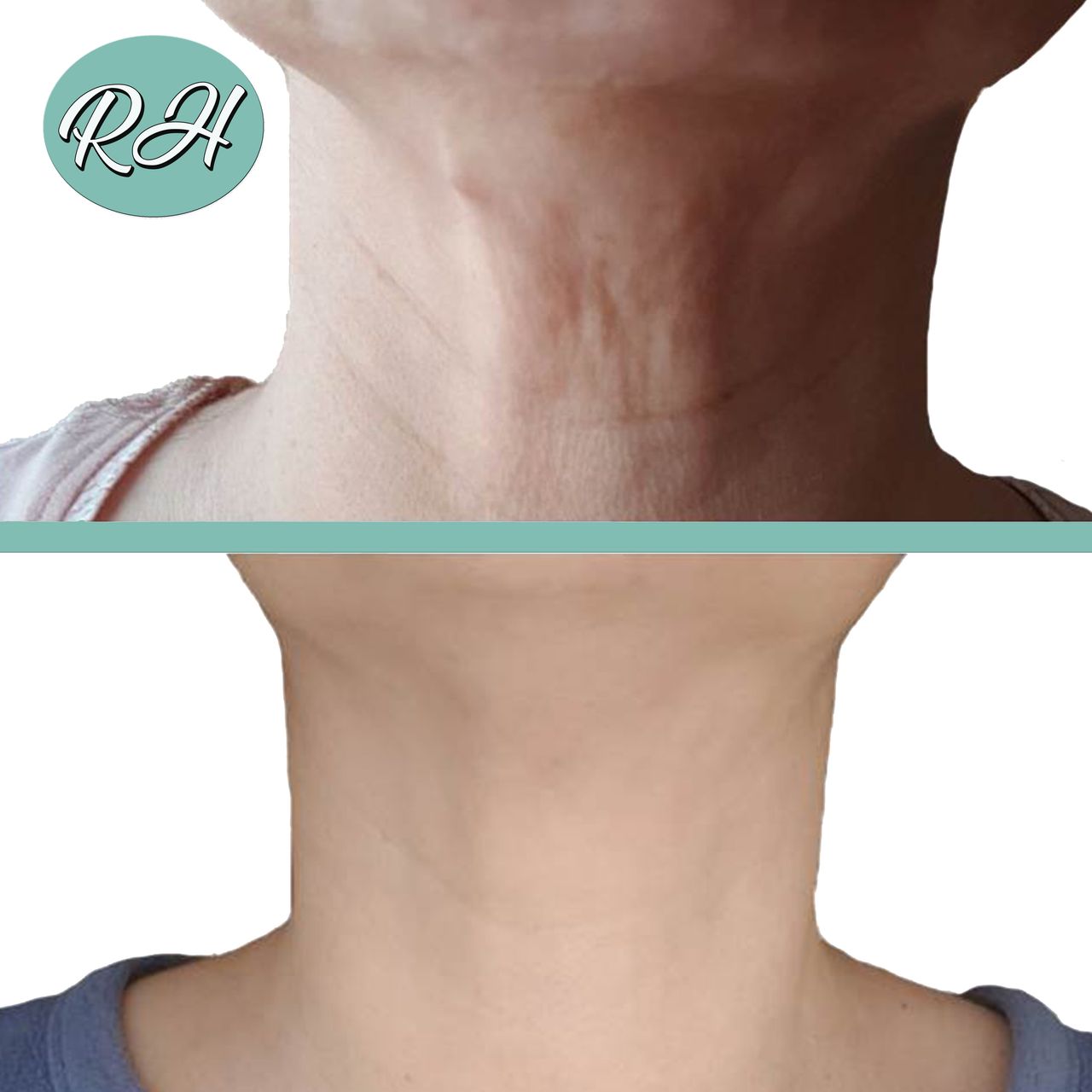 Rosalba Herrero Zerpa-210