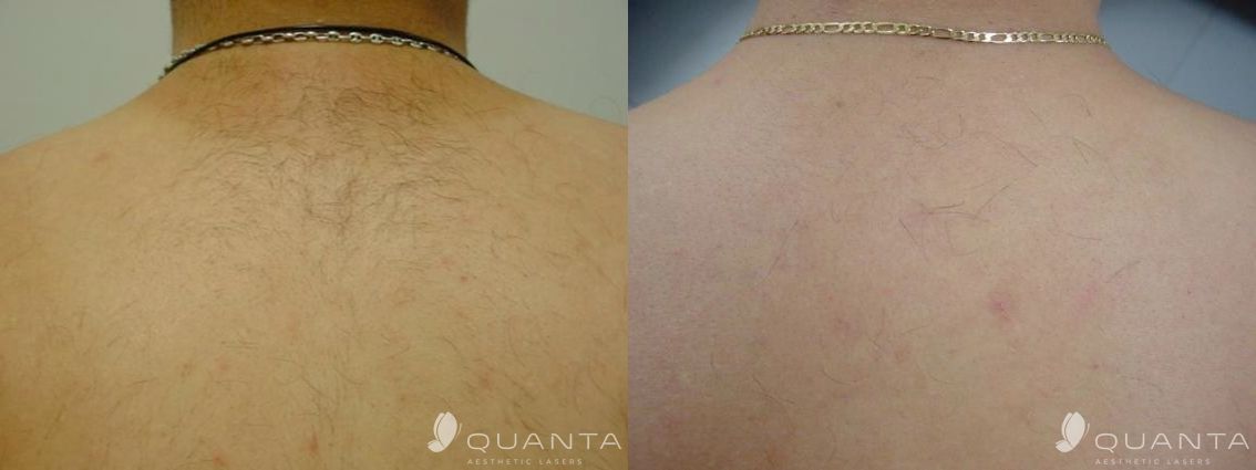 Enzo Angelo Giudice-14