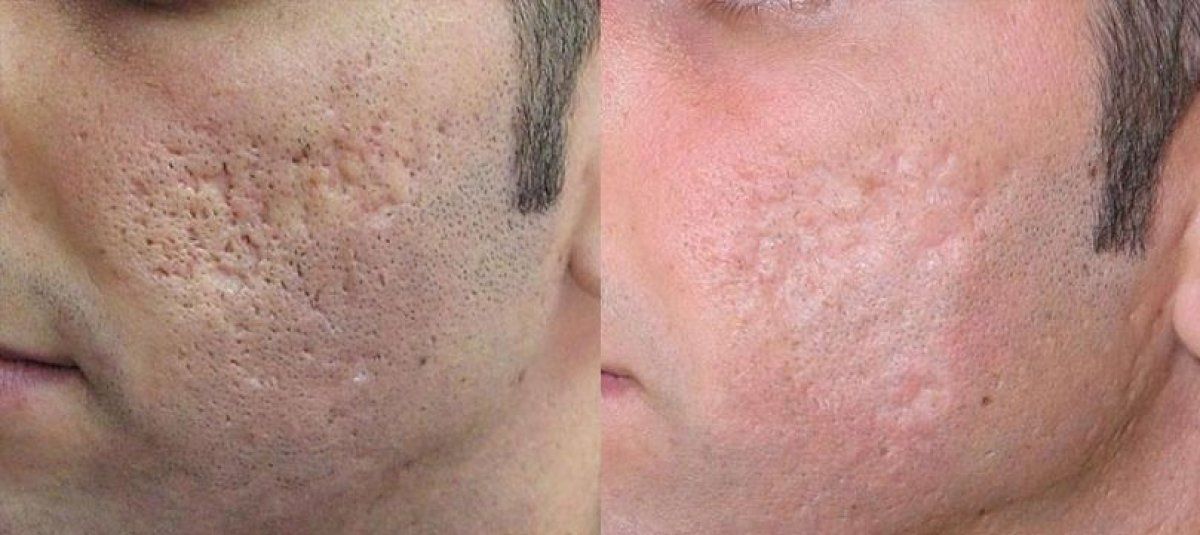 Irina Zvada (Yukhnovets)-4