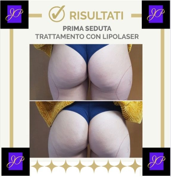 Jacopo Pettinelli-29