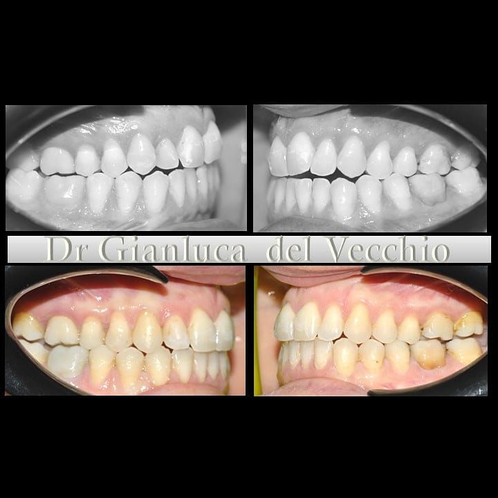 Gianluca Del Vecchio-46