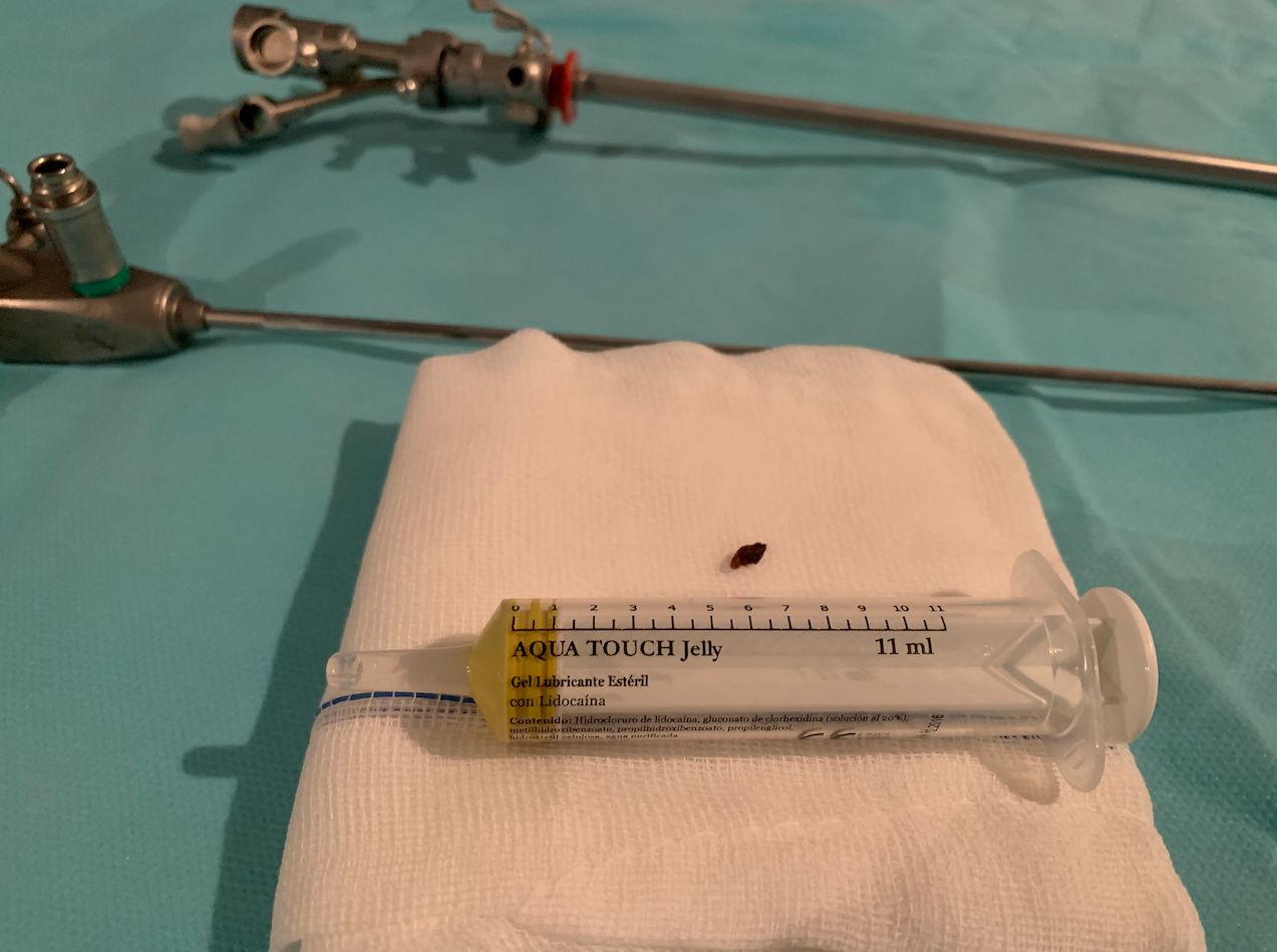 Luis Fernando Susaníbar Napurí-33