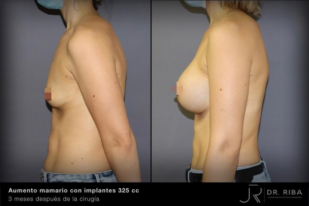 Jordi Riba Vilchez-38