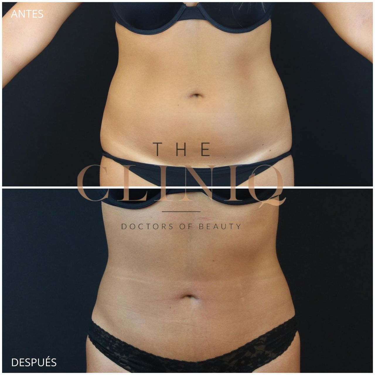 Ricardo Coronel Gagliardi-6