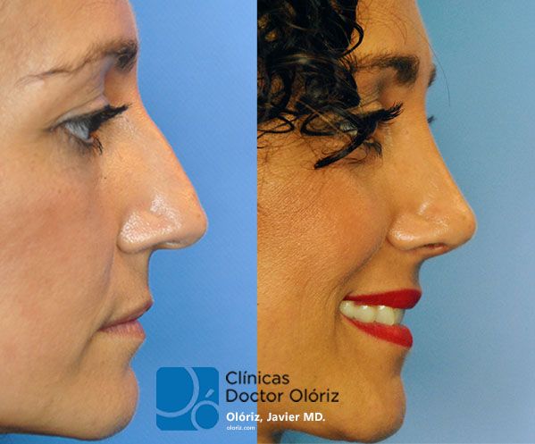 Javier Oloriz Marin-7