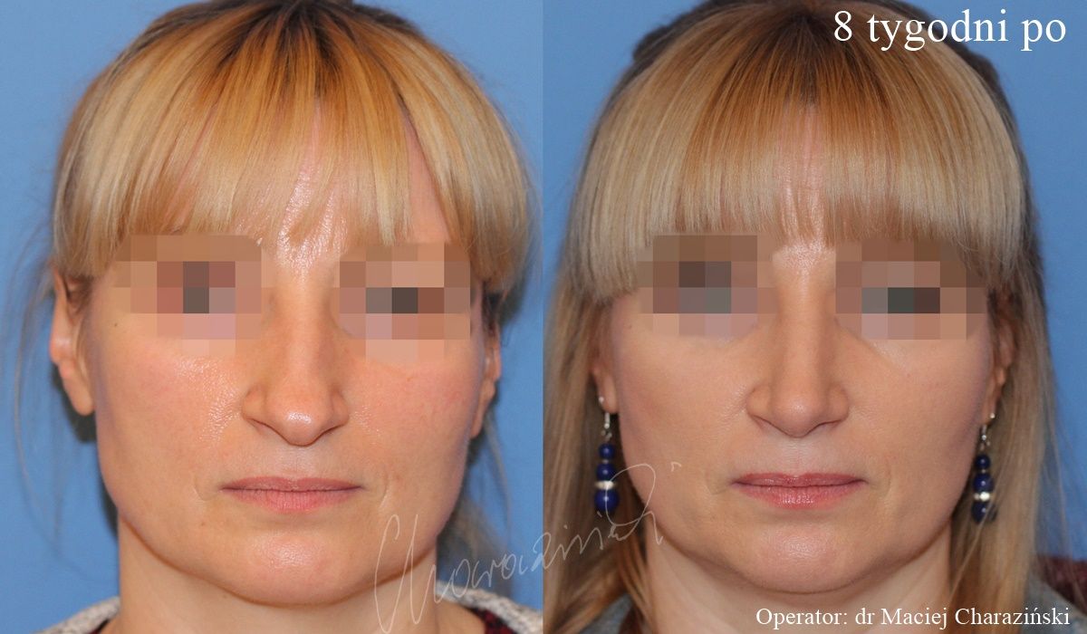 Maciej Charaziński-27