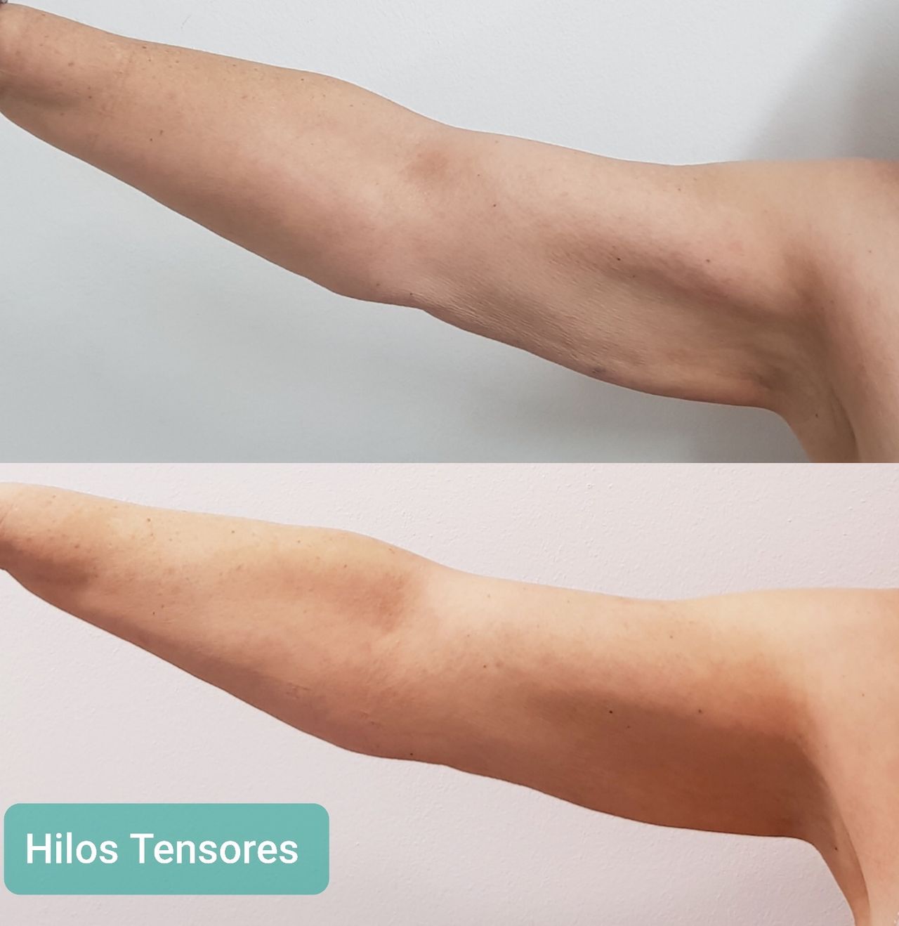 Rosalba Herrero Zerpa-354