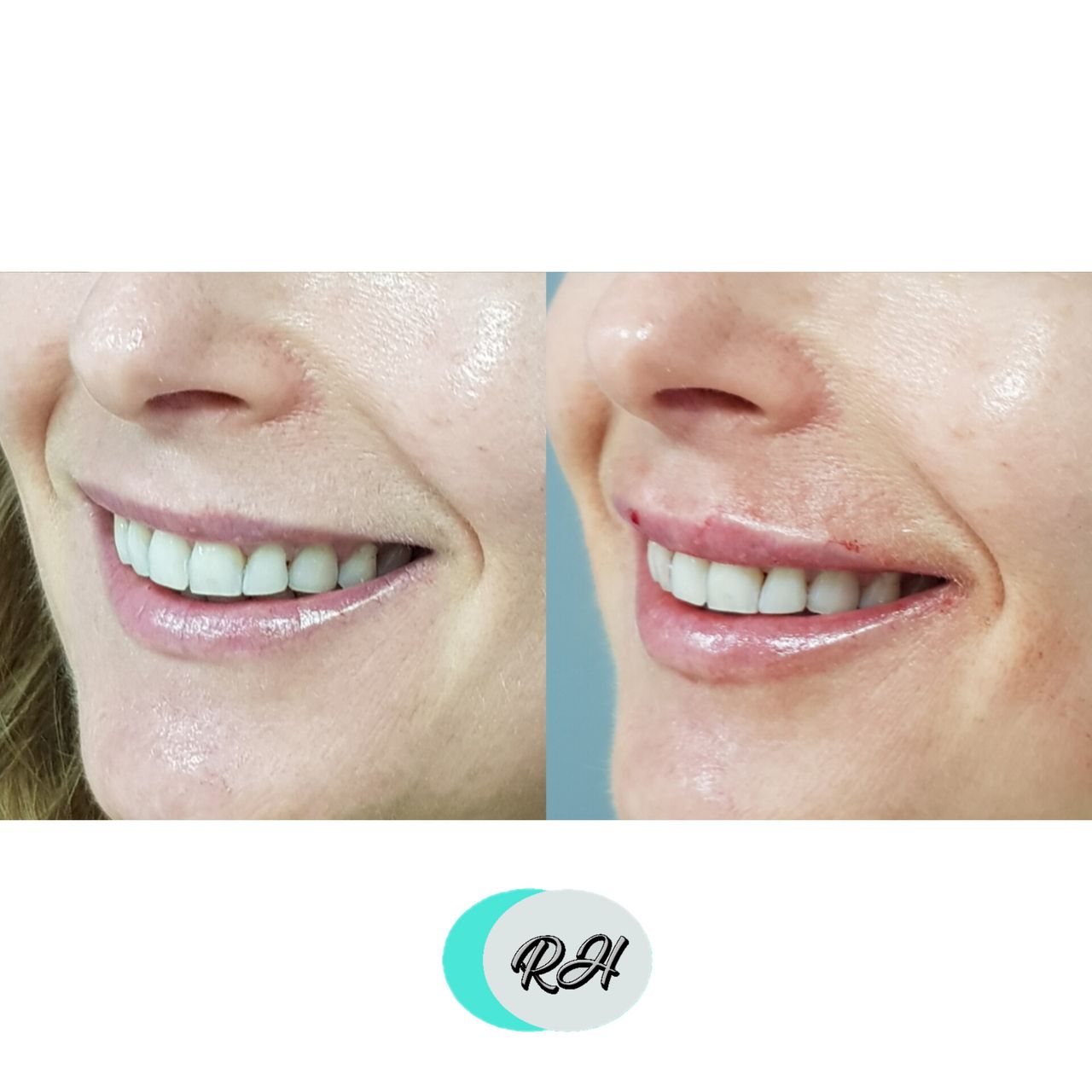 Rosalba Herrero Zerpa-139