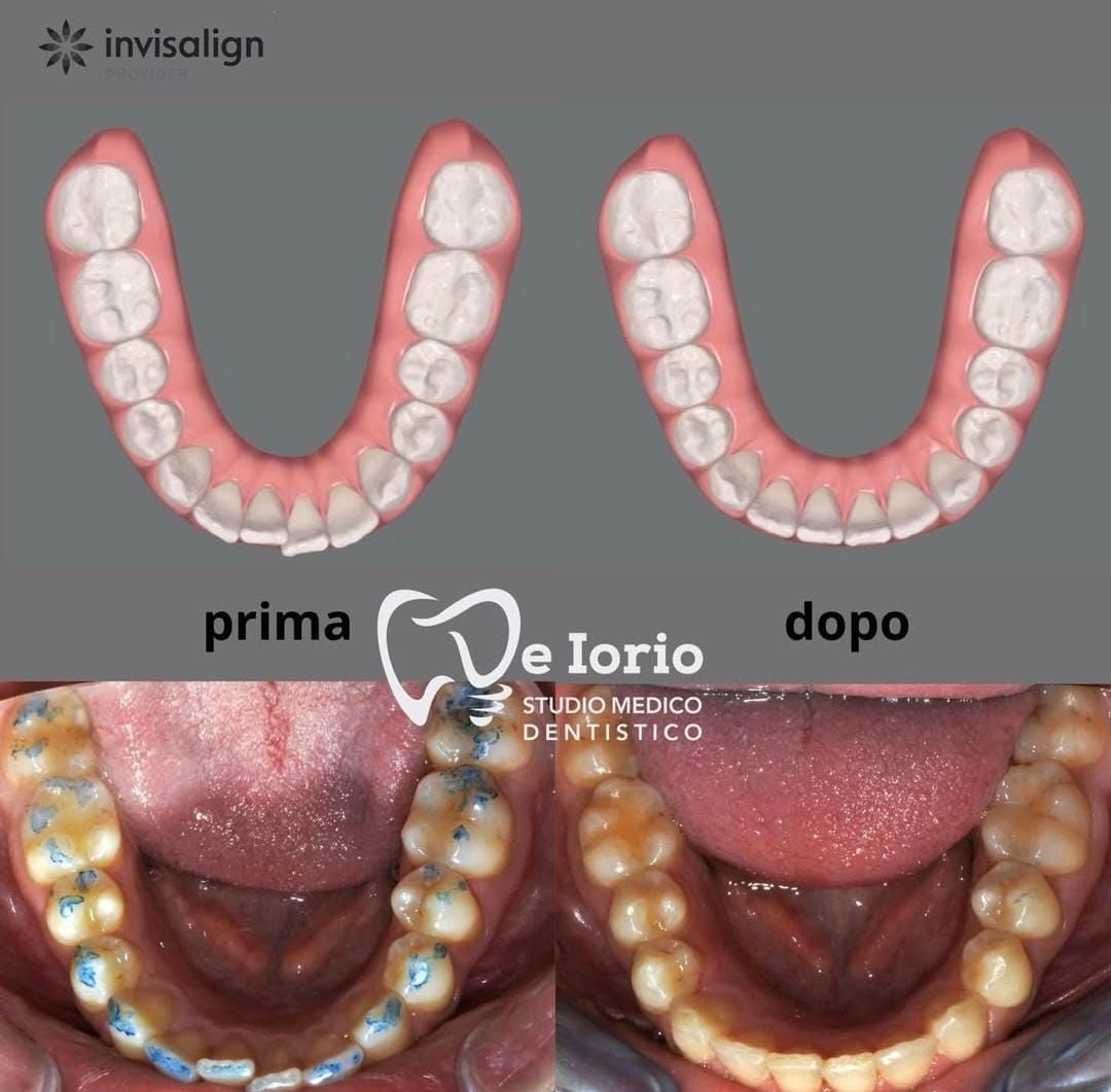 Criseide De Iorio-11