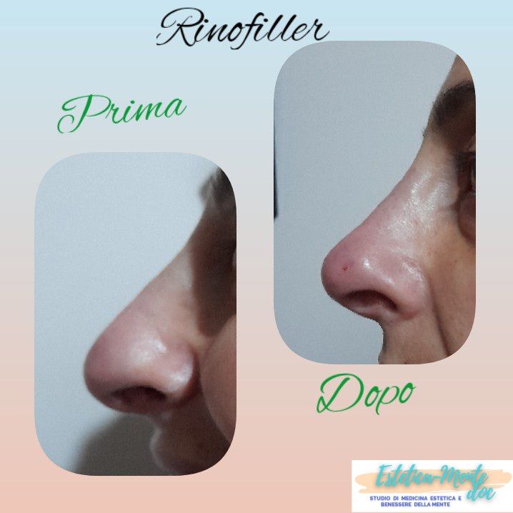 Paola Della Rocca-43