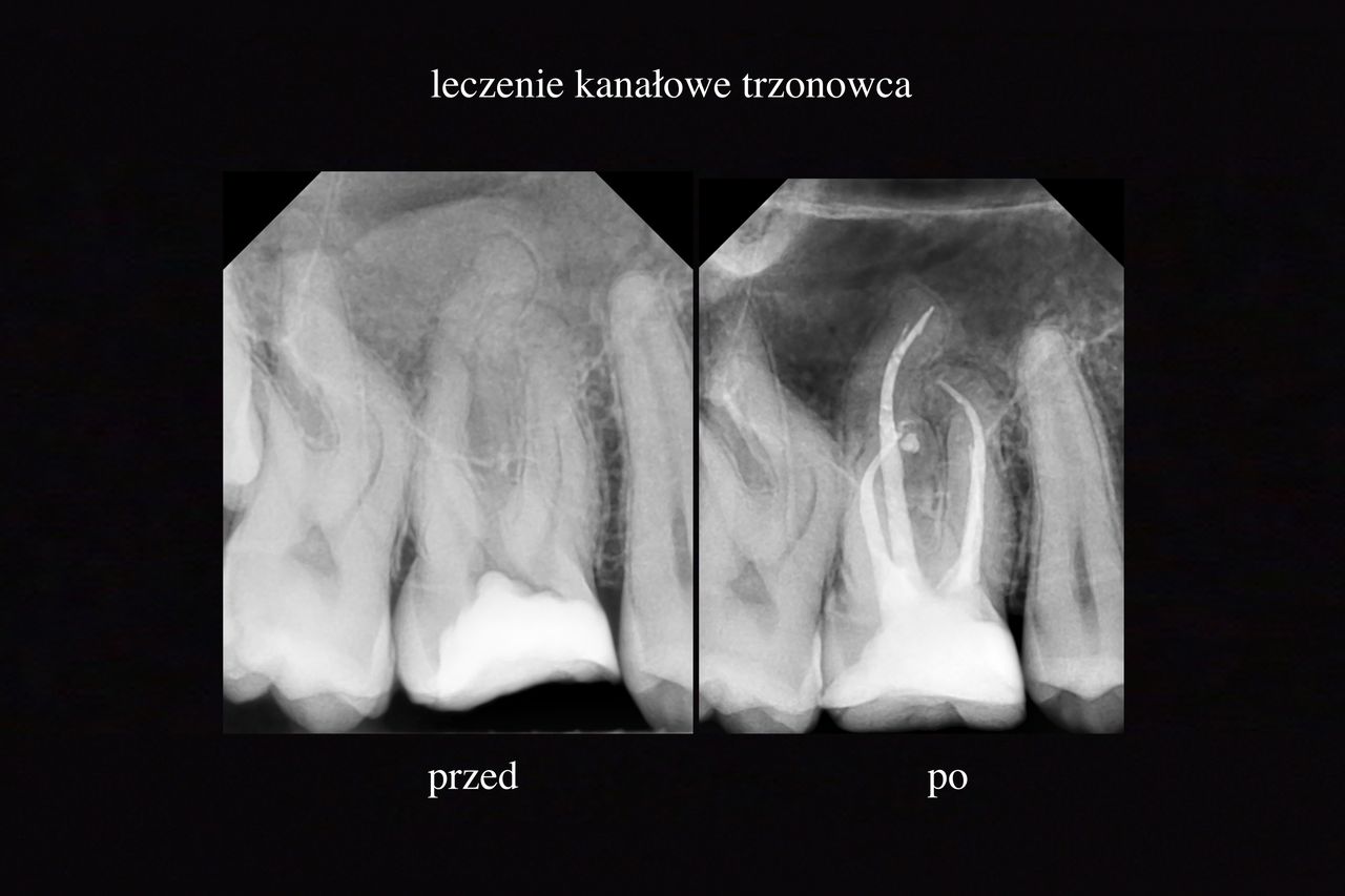 Grzegorz Wójcicki-6