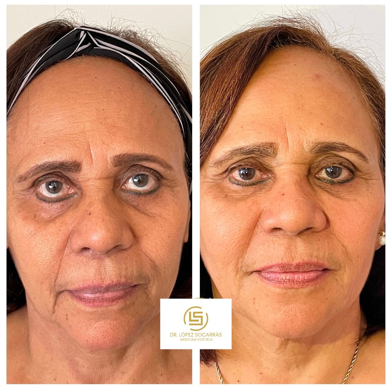 Camilo López Socarrás-10