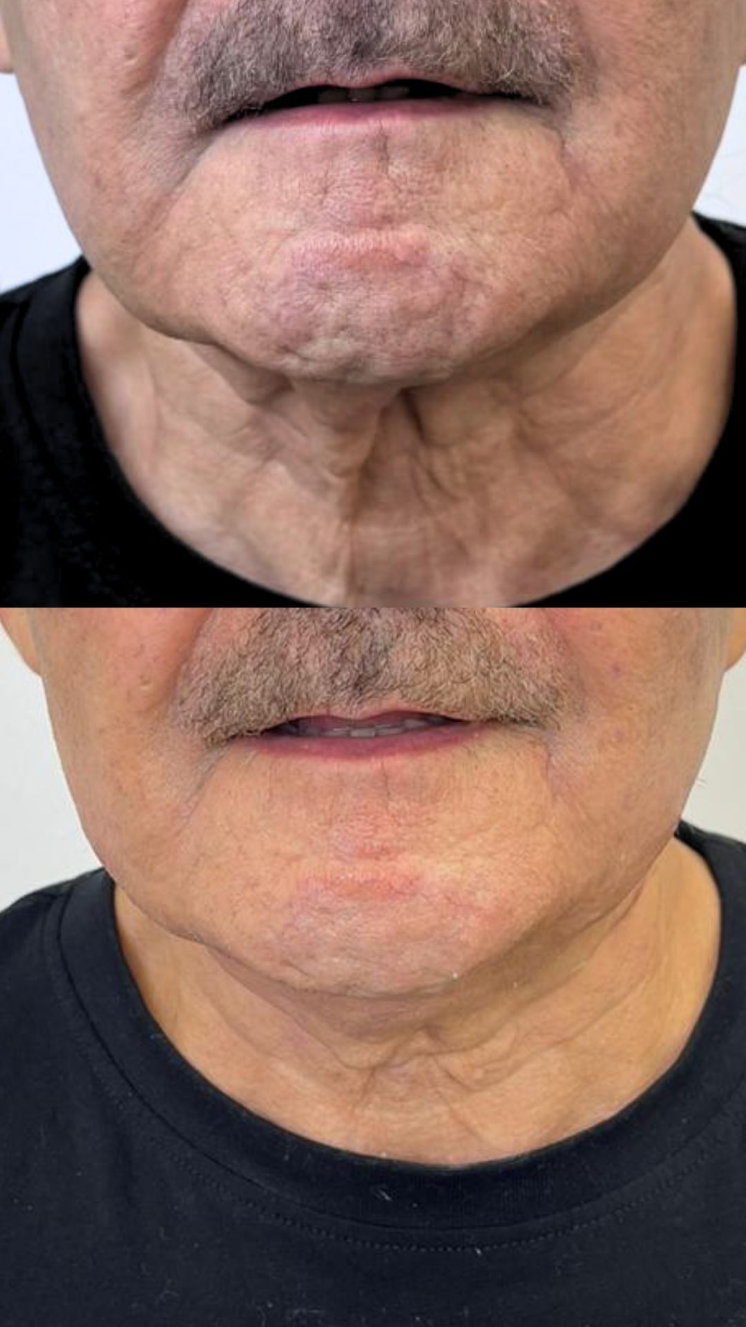 Yusimy Venereo Ramirez-1