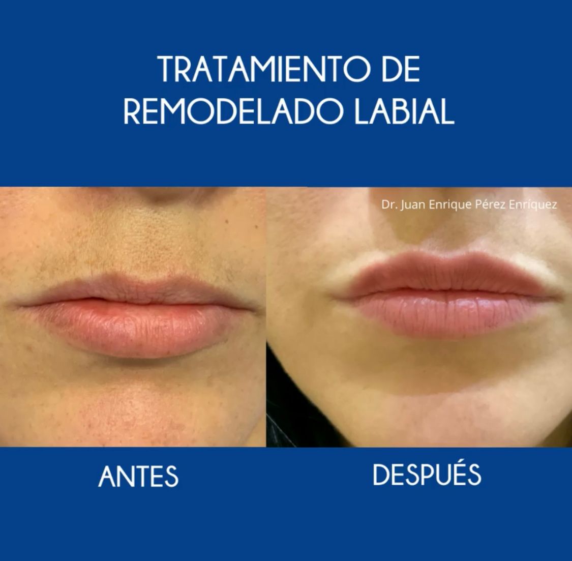 Juan Enrique Pérez Enríquez-27