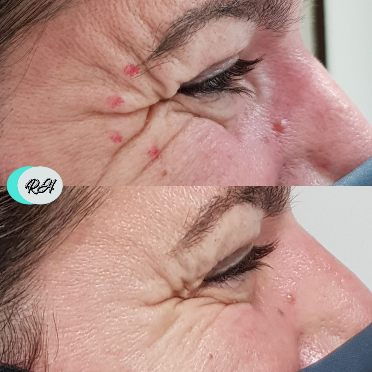 Rosalba Herrero Zerpa-142