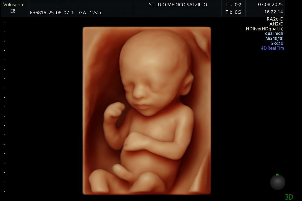 Pier Luigi Salzillo-3