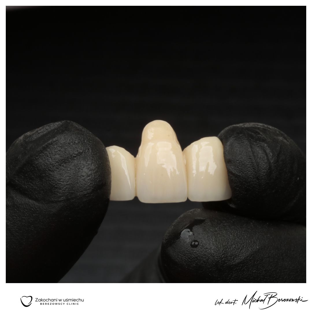 Michał Berezowski-31