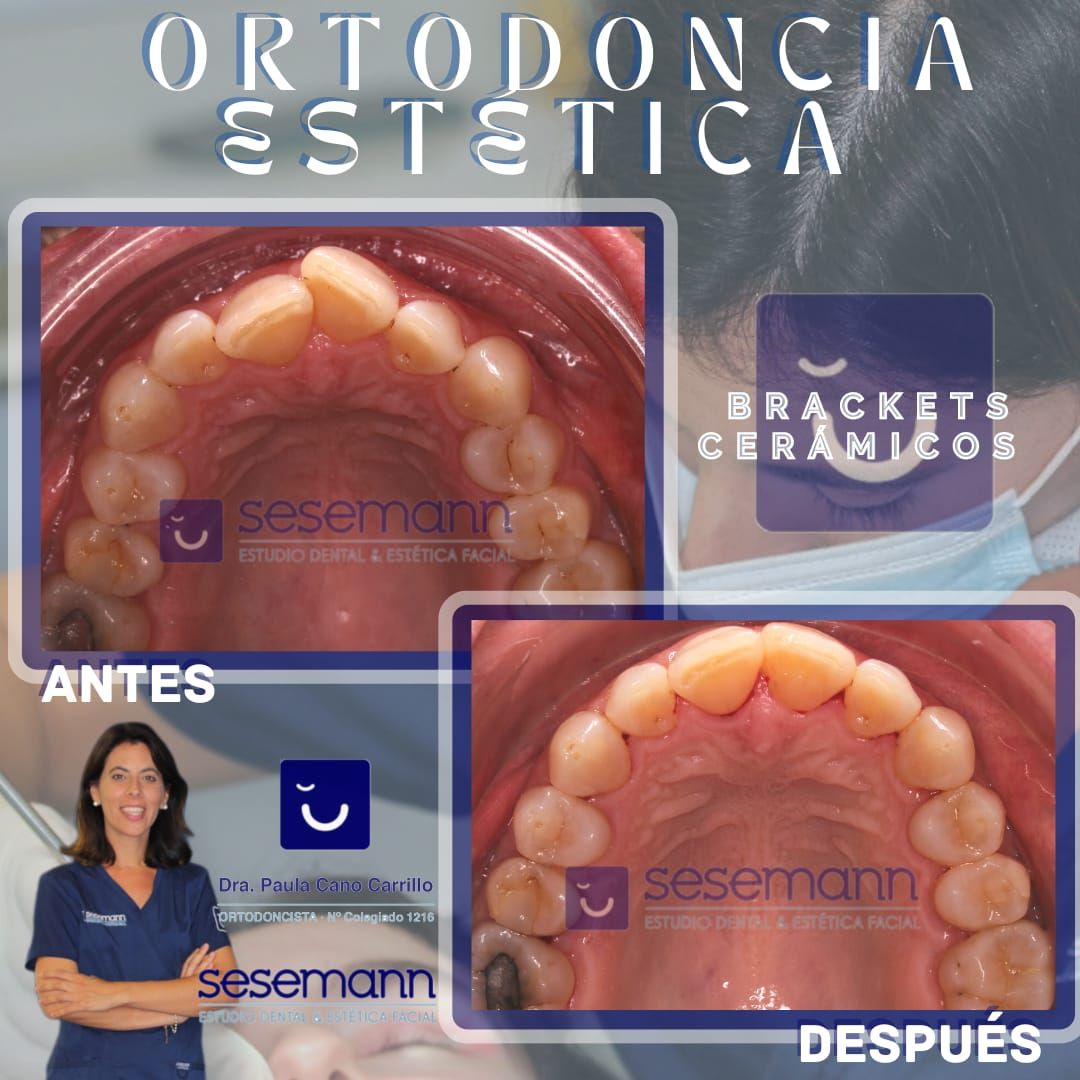 Paula Cano Carrillo-1