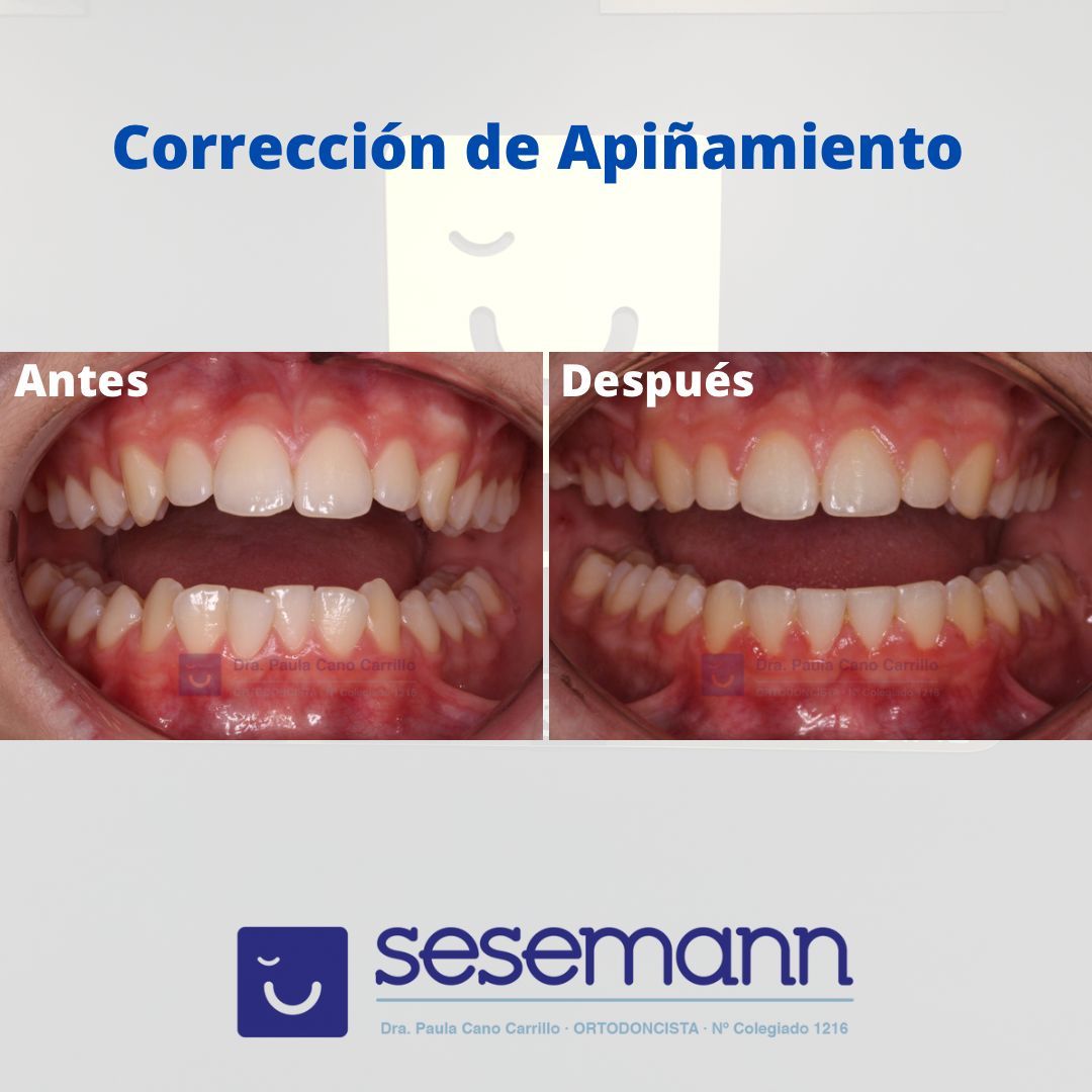 Paula Cano Carrillo-58