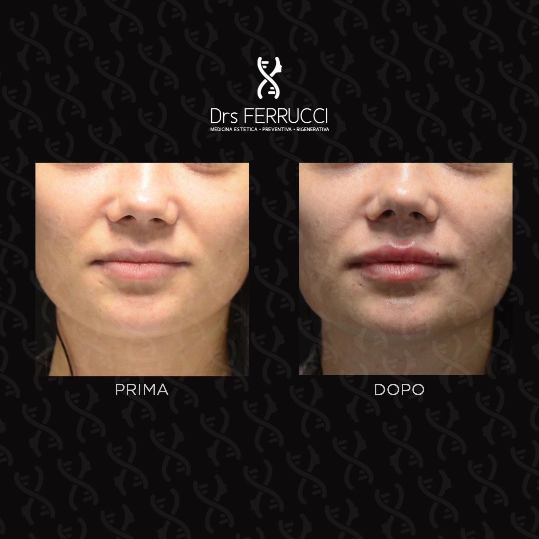 Giuseppe Ferrucci-24