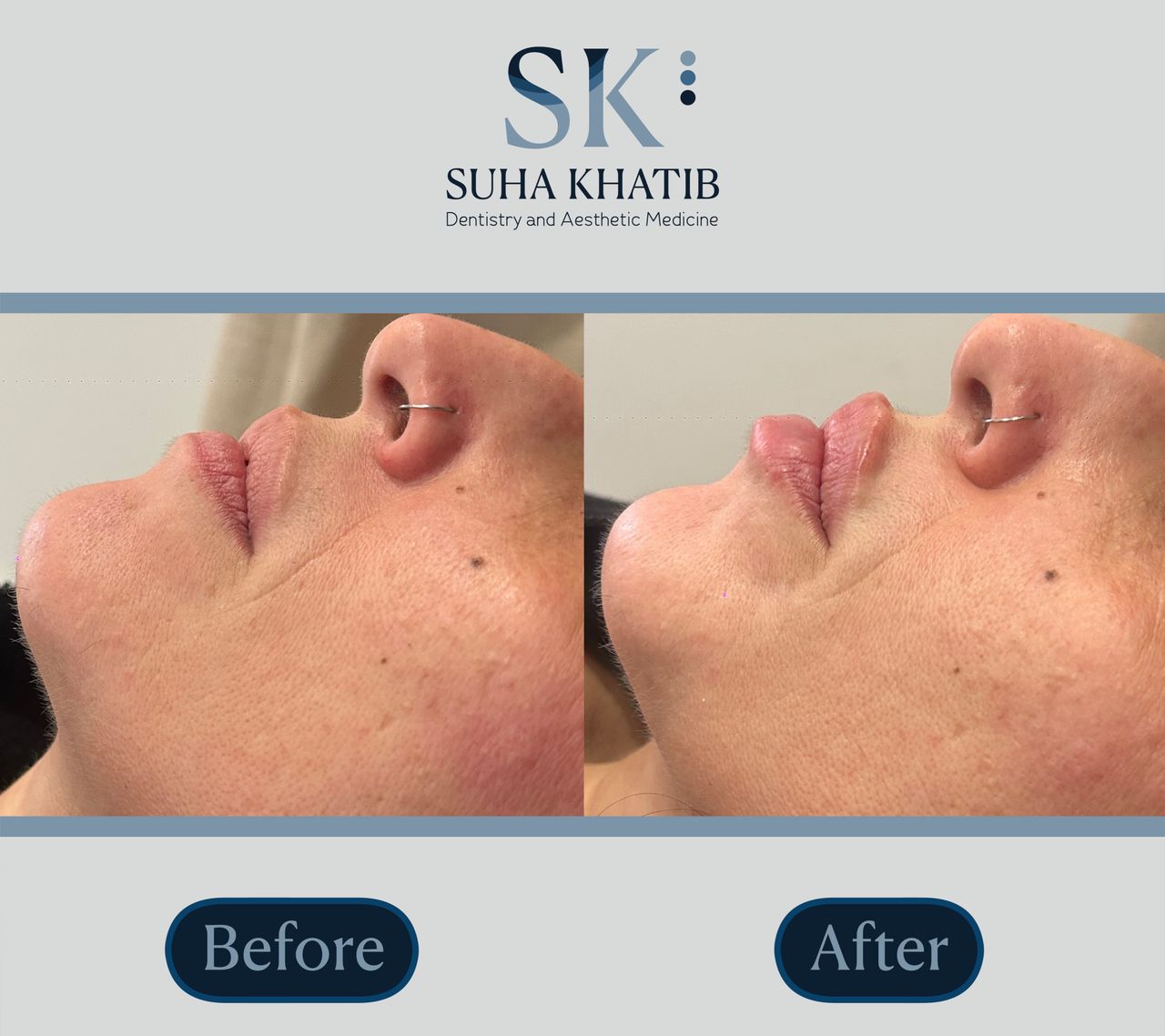 Suha Khatib-31