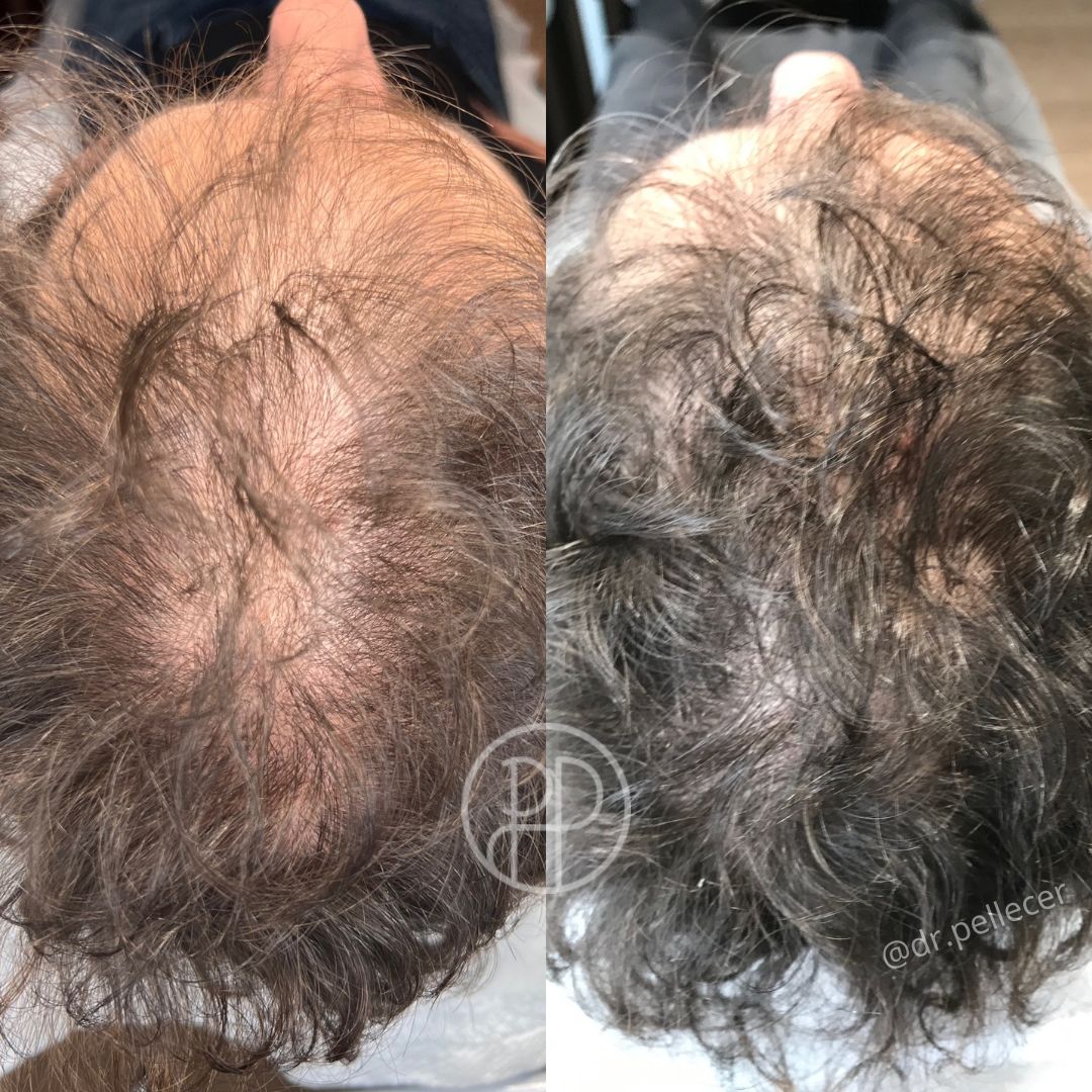 Liliana Paola Pellecer Ruiz-5