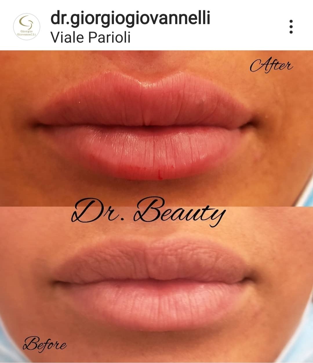 Giorgio Giovannelli-25