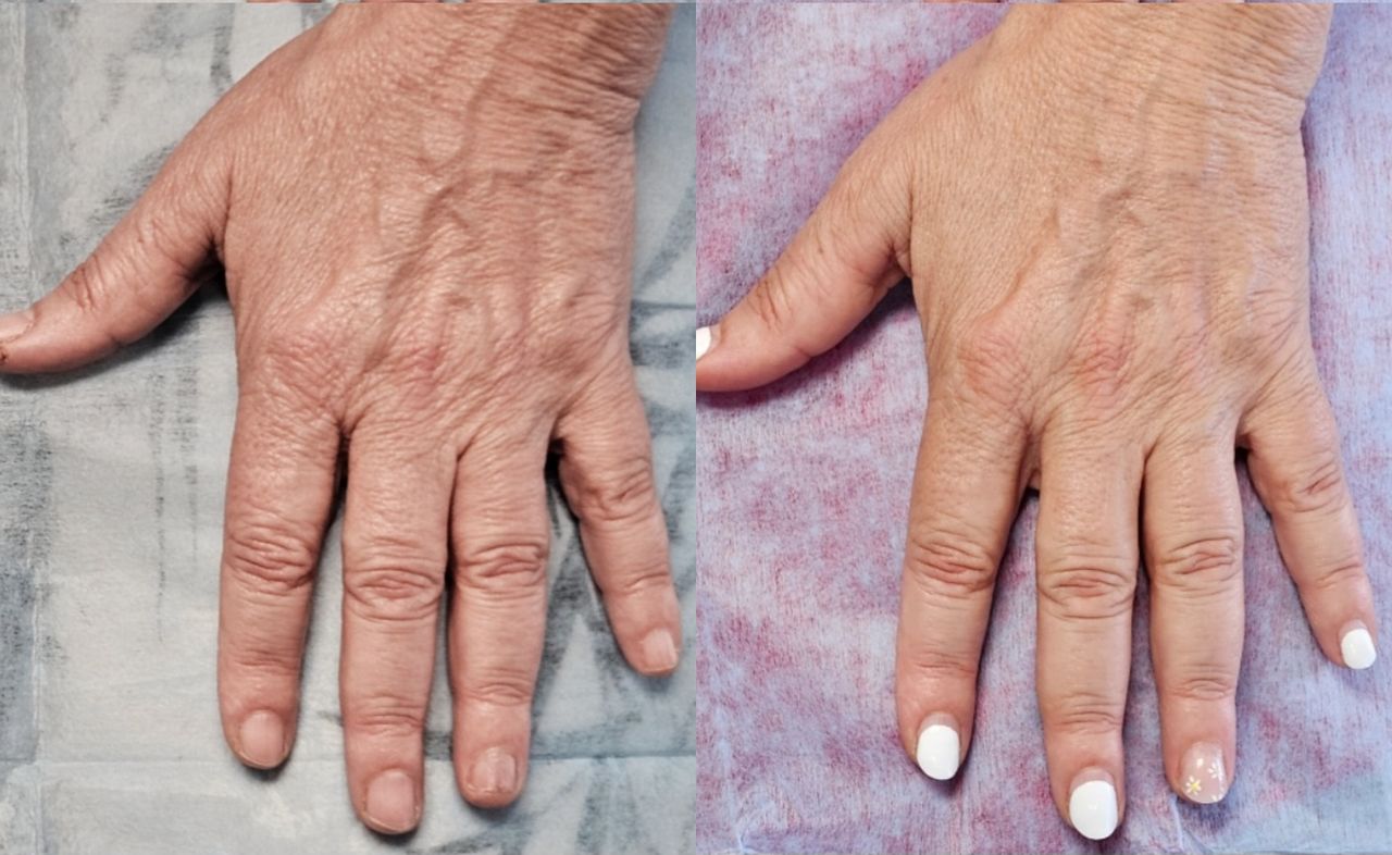 Rosalba Herrero Zerpa-553