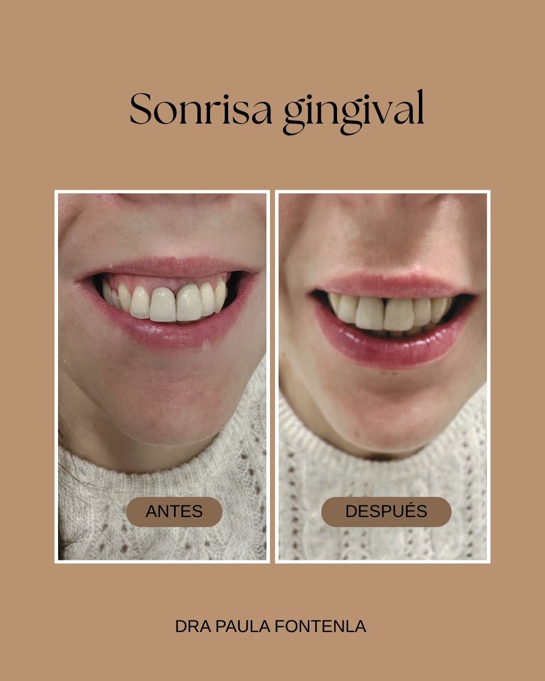 Paula Fontenla Seco-5