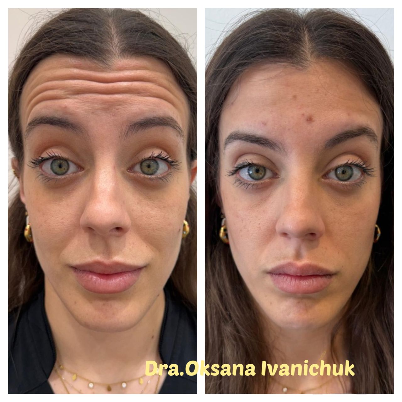 Oksana Ivanichuk-1