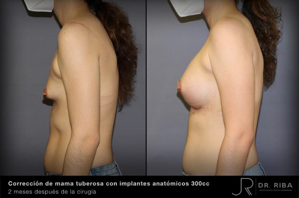 Jordi Riba Vilchez-12