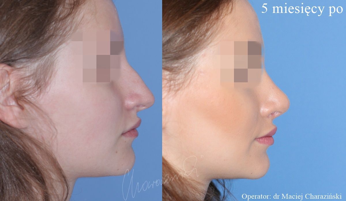 Maciej Charaziński-75