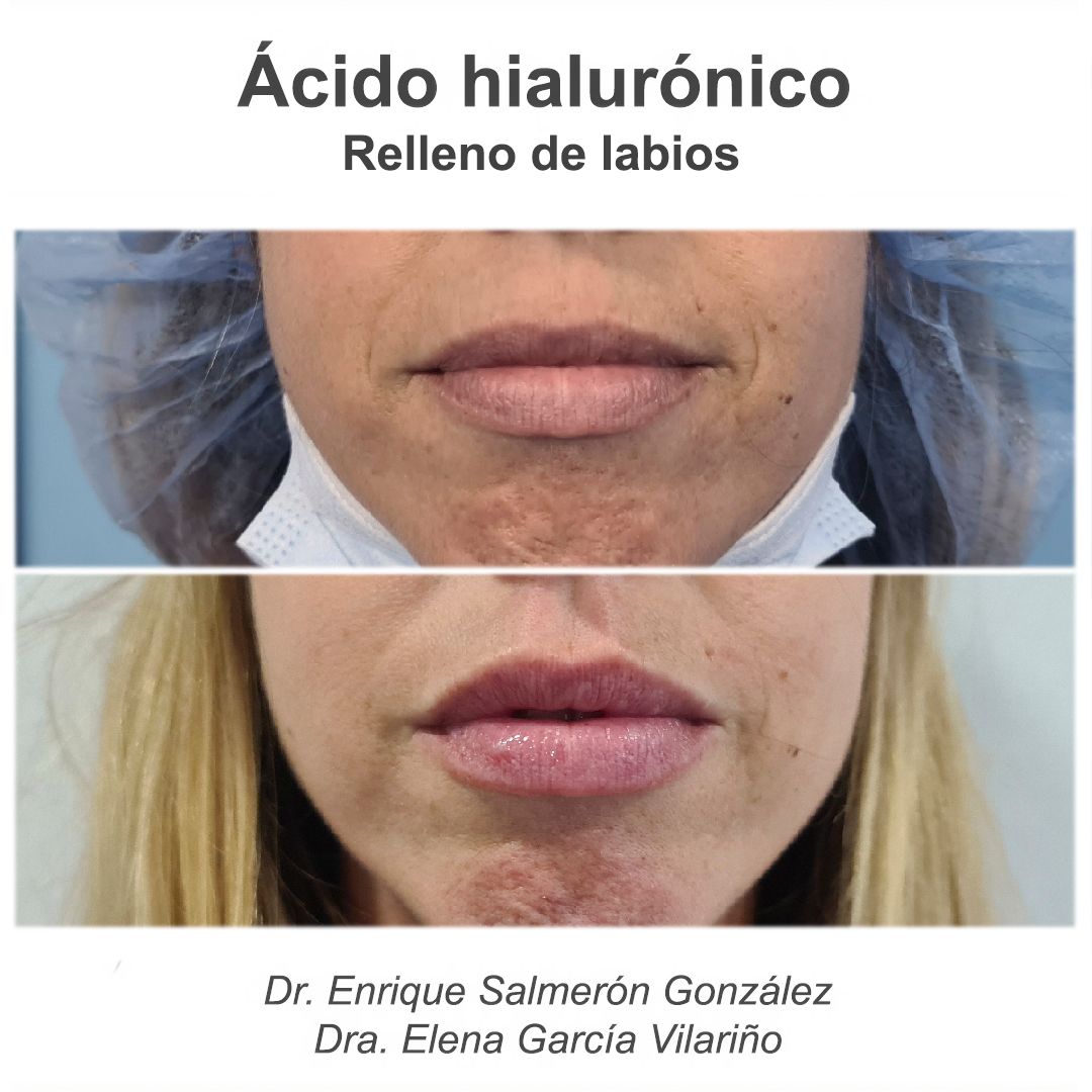 Enrique Salmerón González-77