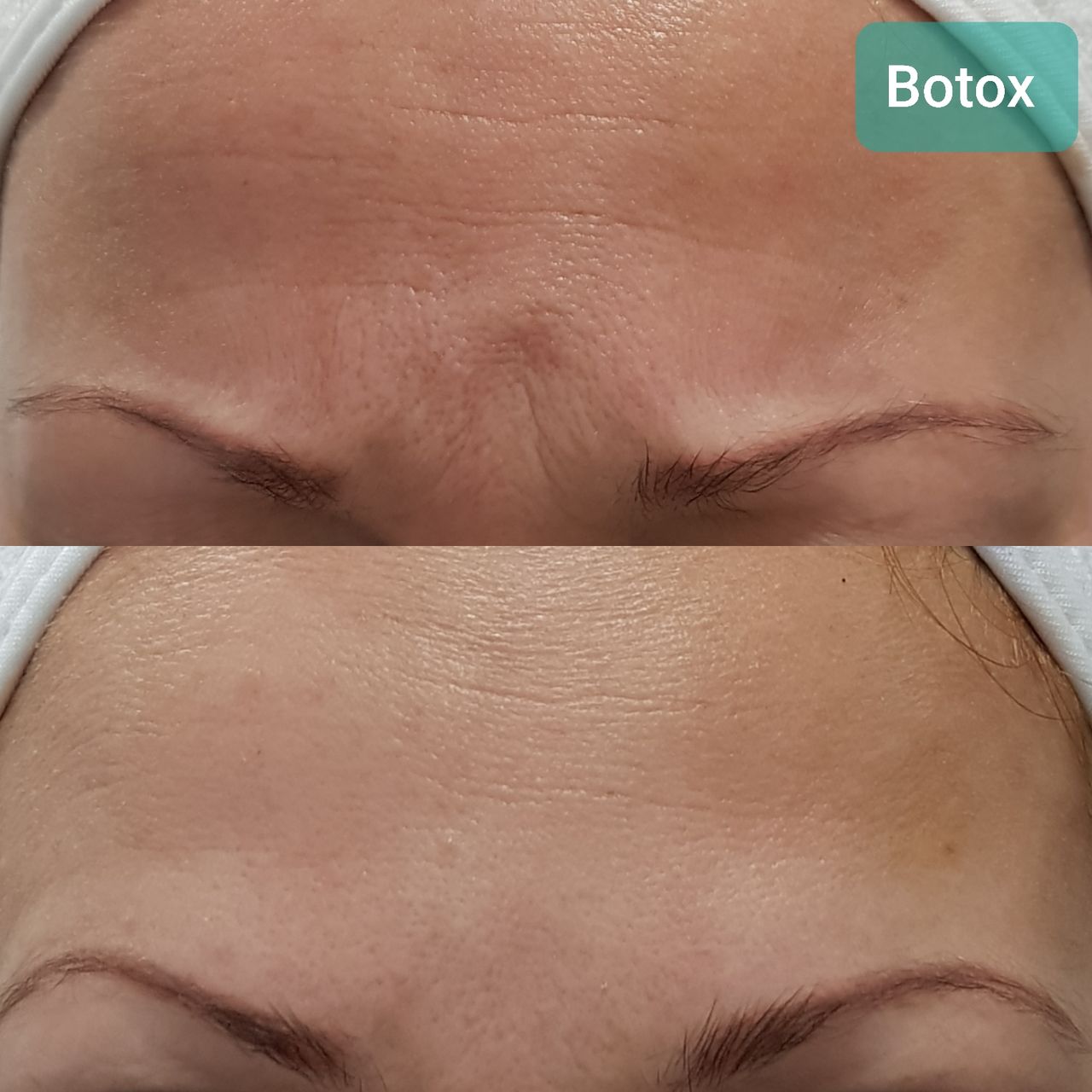 Rosalba Herrero Zerpa-351