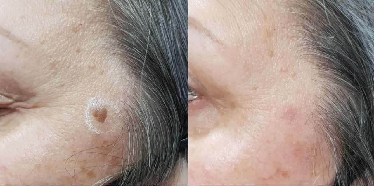 Rosalba Herrero Zerpa-220