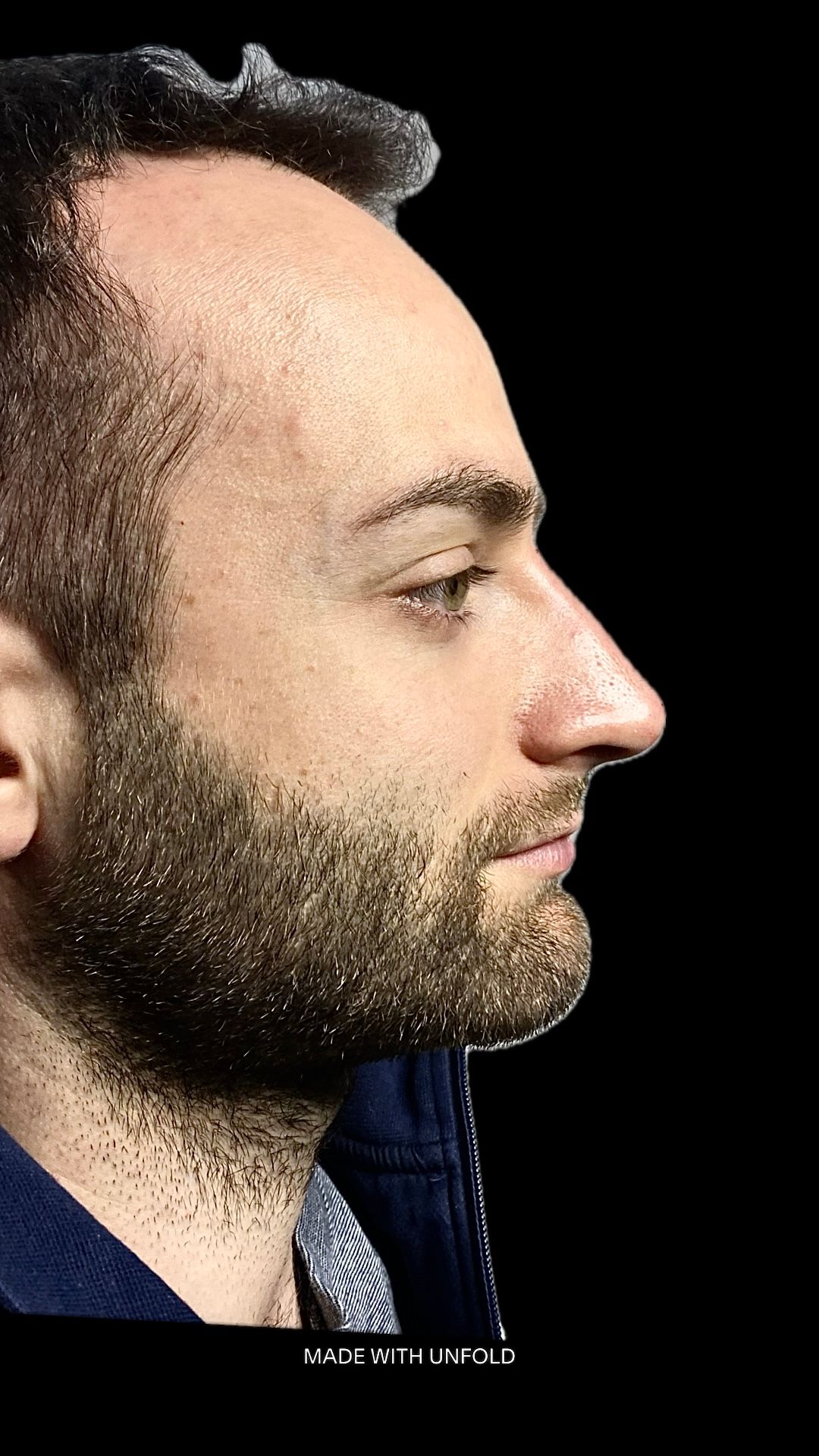 Valerio Lorenzano-12