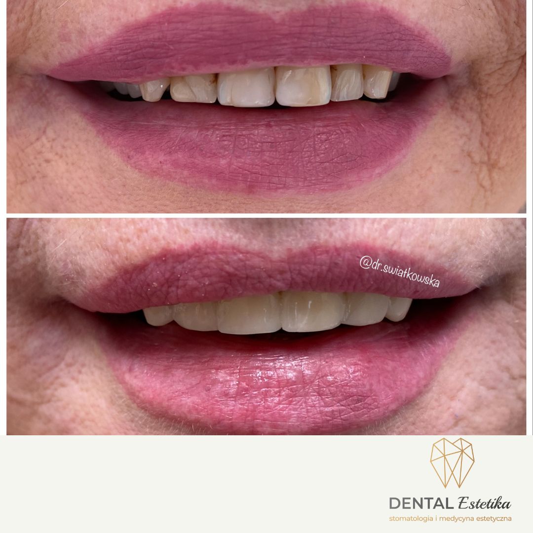 Angelika Świątkowska-17